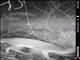 Gray Fox (Urocyon cinereoargenteus)